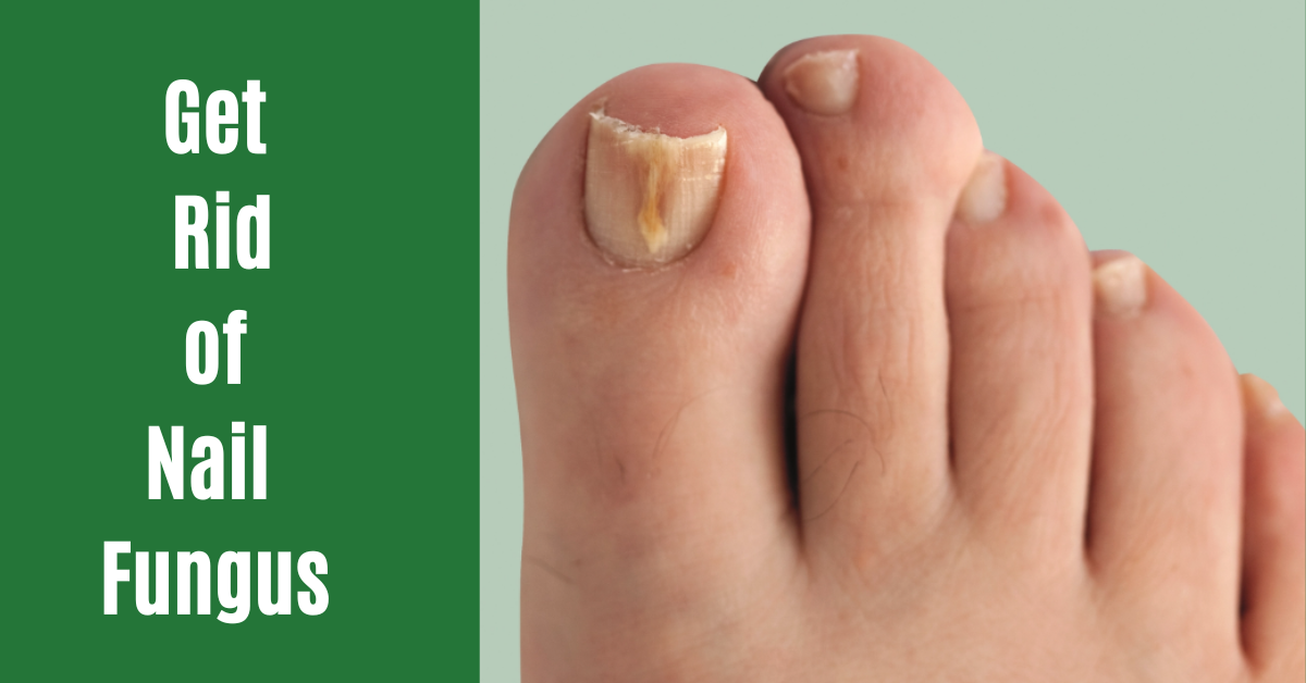 Best Nail Fungus Treatment (USA)- Ideal Way To Kill Nail Fungus
                       